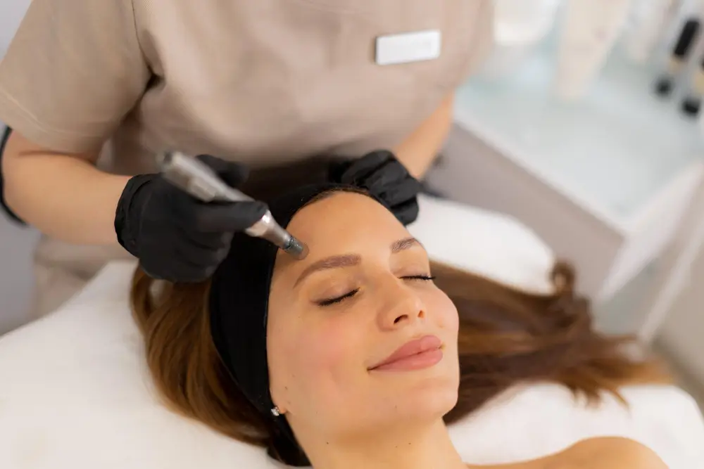microneedling face treatment El Dorado Hills